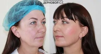 Фото до и после